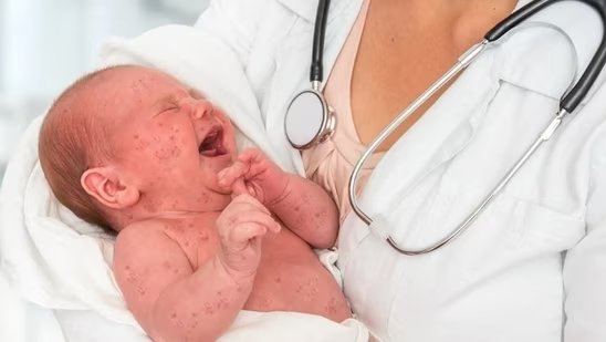 skin diseases in baby