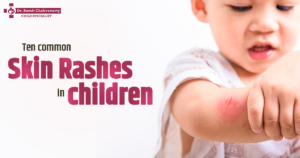 Skin Rashes in Children